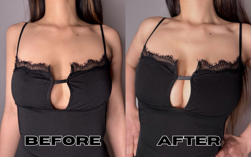 Miayilima Women's Sticky Detachable Strap Backless Bra Self Adhesive  Invisible Push Up Bra 